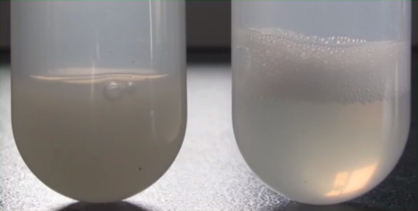 超声前(左)超声后(右) 超声前(左)超声后(右)